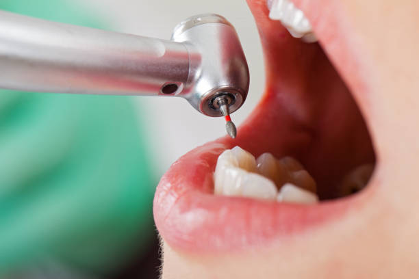 Best Weekend Emergency Dentist in Newburgh, IN